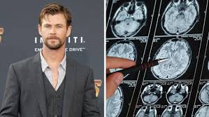 Chris Hemsworth Alzheimer’s risk